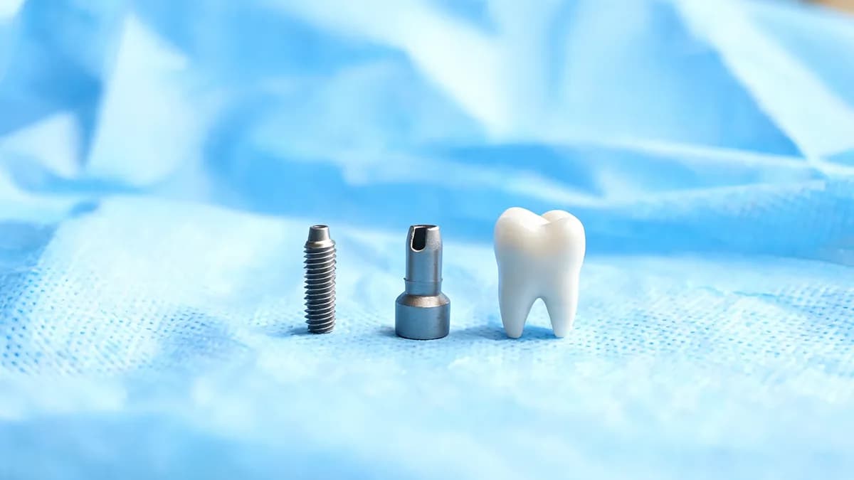 Dental implant components on a blue sterile drape: a titanium implant screw, an abutment and a model crown